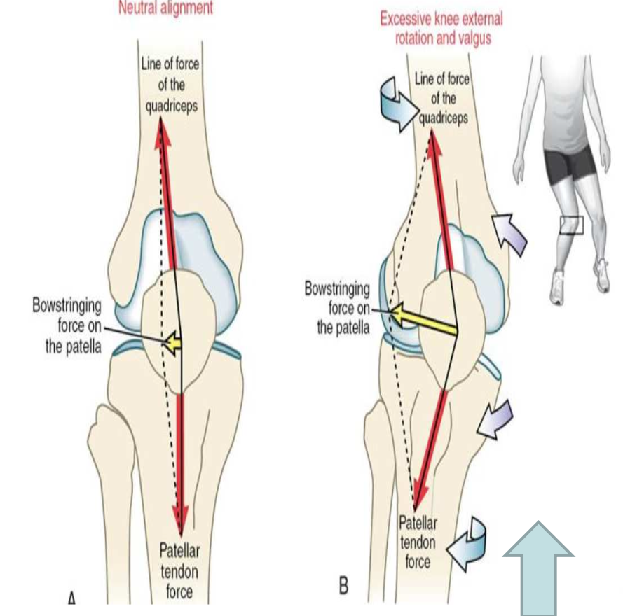 knee valus를 보여주는 그림