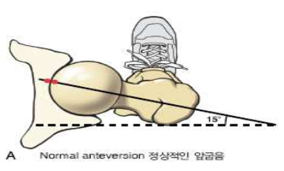 앞굽음각 그림